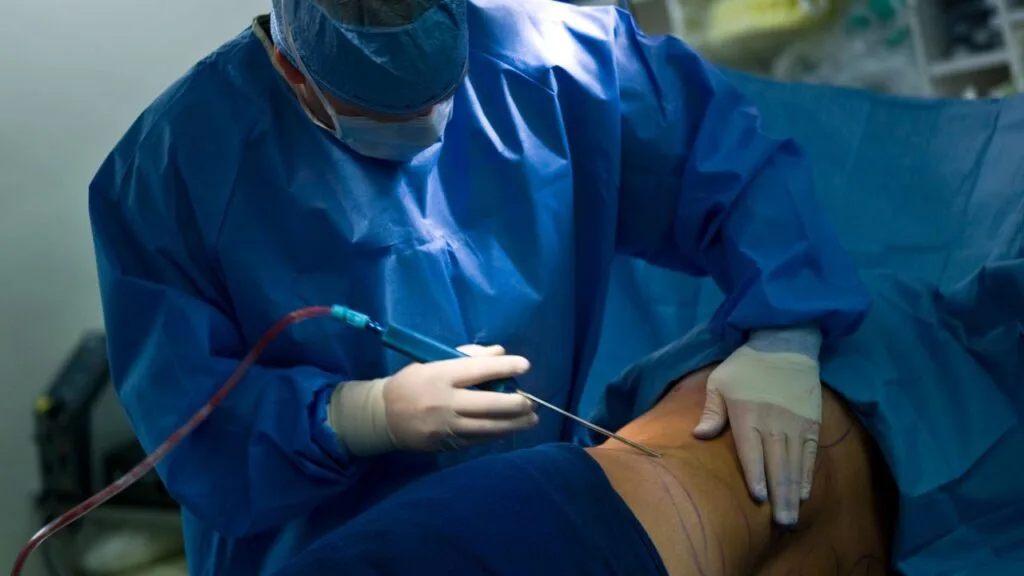 Remueve grasa localizada y define los músculos abdominales mediante tecnologías avanzadas como MicroAire y UltraZ. Brinda una silueta más firme y tonificada, resaltando los contornos naturales del cuerpo con resultados precisos y estables.