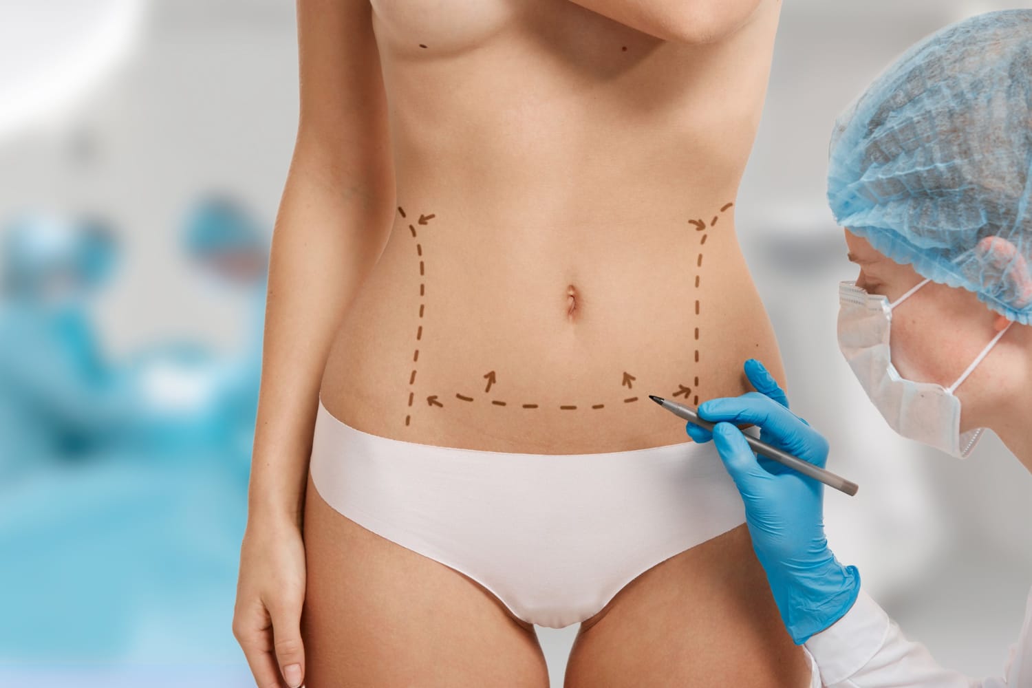 Mastopexia 20 Liposuction / Abdominal Etching