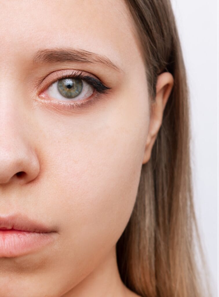 Resultado de blefaroplastia con párpados más firmes y mirada descansada
