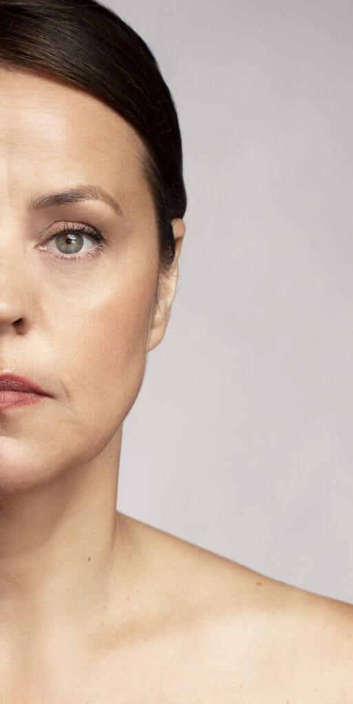 Primer plano de ojos sin arrugas tras tratamiento de Facial Botulinum para suavizar patas de gallo y líneas de expresión