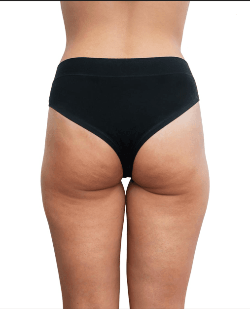 cruroplastia01 - Dr. Jaime Aroca - Cirujano Plástico en Colombia, Especialista en Abdominoplastia