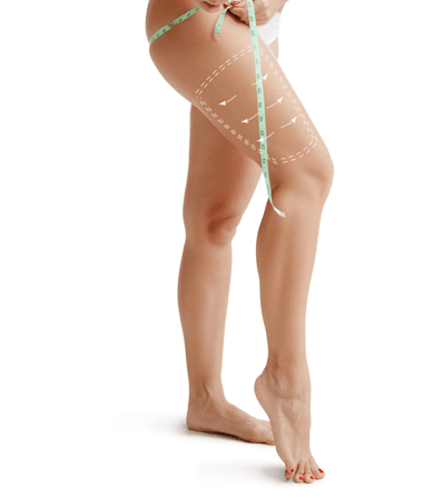 cruroplastia03 - Dr. Jaime Aroca - Cirujano Plástico en Colombia, Especialista en Abdominoplastia